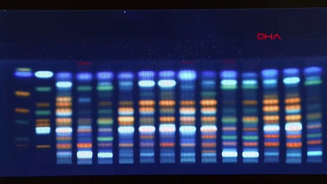 İnternette ölümcül ticaret ifşa oldu: İçeriklerinde sibutramin tespit edildi!