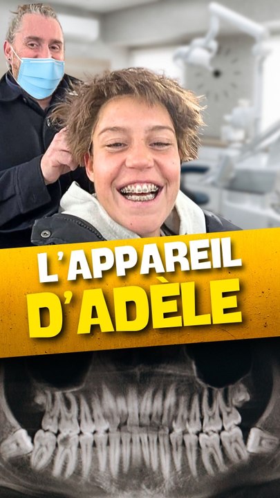L'APPAREIL DENTAIRE d'ADELE