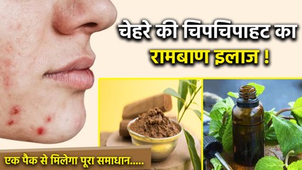 Sandalwood Mint Face Pack In Summer:गर्मियों में चेहरे की चिपचिपाहट का रामबाण इलाज,Benefits In Hindi