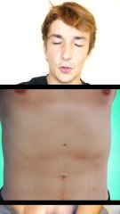 Bypass Gastric Surgery Overview