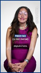 « Je suis malheureuse là, tout de suite » : et si on osait le dire ? Après l’accouchement, on fait