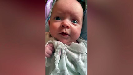 Two-month-old Macey-Mai was born with giant congenital melanocytic nevus (GCMN)