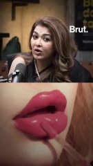 Why more young faces are turning to botox