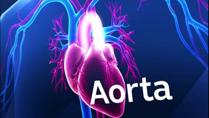 How a 3D printed aorta helped surgeons replace a 'ticking time bomb' inside a man's chest