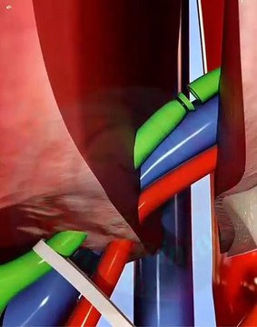 Procedure of liver transplant
