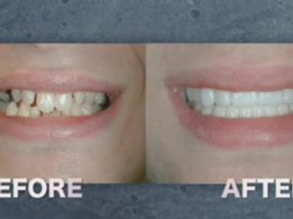 Beverly Hills Plastic Surgeon of the Smile | 90210