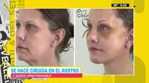 Se hace cirugía en el rostro y queda irreconocible