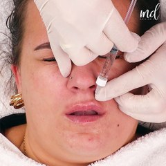 Pout perfection in progress! 💋