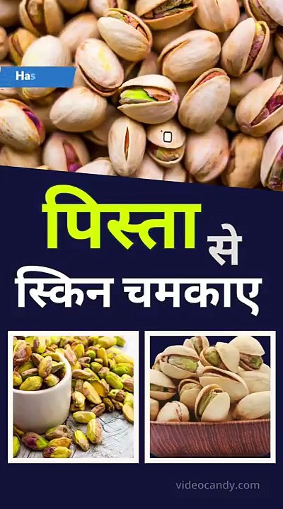 Amazing Benefits of Eating Pistachios