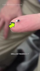 This Is The World’s Smallest Pacemaker