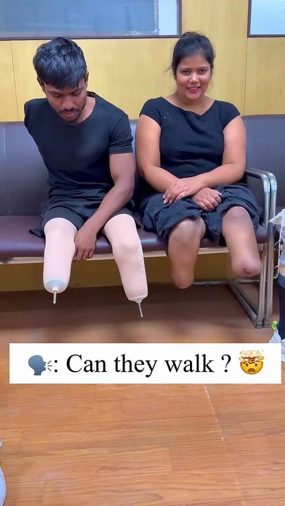 Below knee Amputation leg Artificial leg Artificial leg