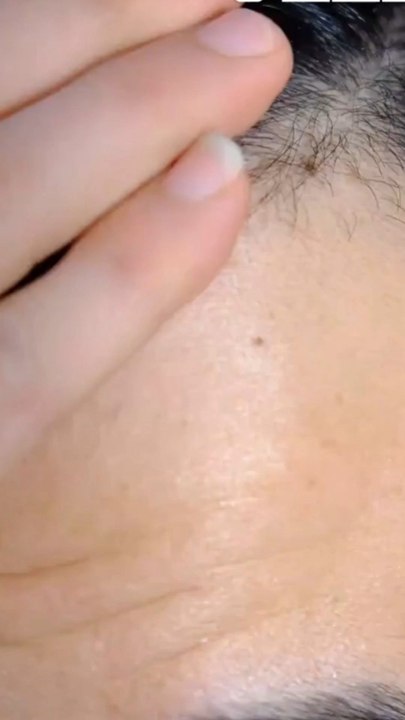 Top 10 Hair Transplant Clinics in Dubai (2025) | Real Reviews, Real Results 💇‍♂️🇦🇪#HairTransplantDubai #HairRestoration #DubaiClinics #HairTransplant2025 #HairLossSolution #ConfidenceMatters #UAEQuest