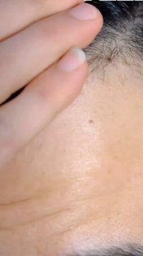 Top 10 Hair Transplant Clinics in Dubai (2025) | Real Reviews, Real Results 💇‍♂️🇦🇪#HairTransplantDubai #HairRestoration #DubaiClinics #HairTransplant2025 #HairLossSolution #ConfidenceMatters #UAEQuest