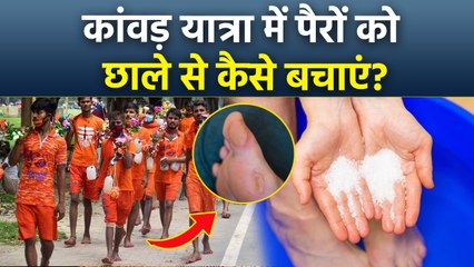 Kanwar Yatra 2025: पैरों में छाले क्यों होते हैं,कांवड़ यात्रा में पैरों को छाले से कैसे बचाएं....