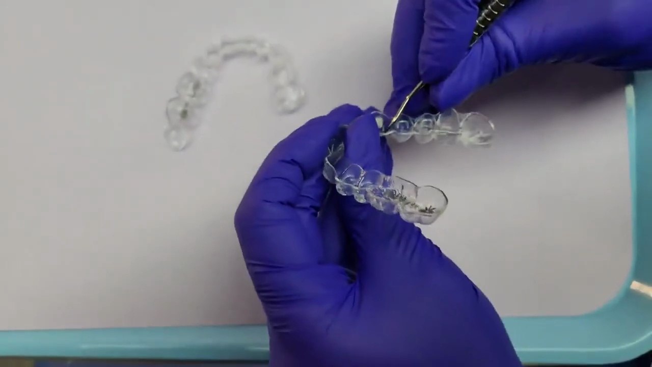 Broken or Cracked Invisalign Aligners