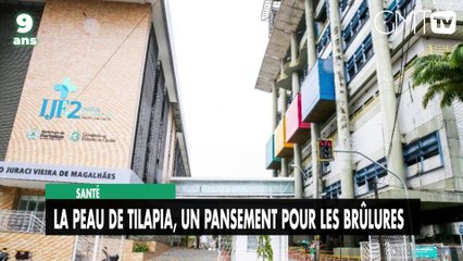 [#Reportage]  Santé : la peau de tilapia, un pansement pour les brûlures !