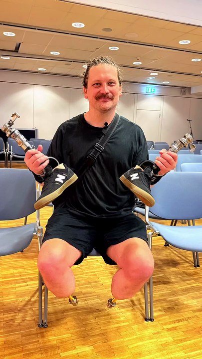 Below Knee Legs | Osseointegration in Legs | Amputation Life | Nakli Tang | Implants | Prosthetic Legs | ISPO |