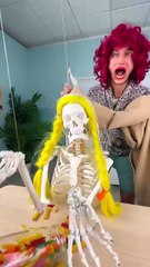 Lesson Learned: Never Pull Off Hangnails! 😬🖐️ #funny