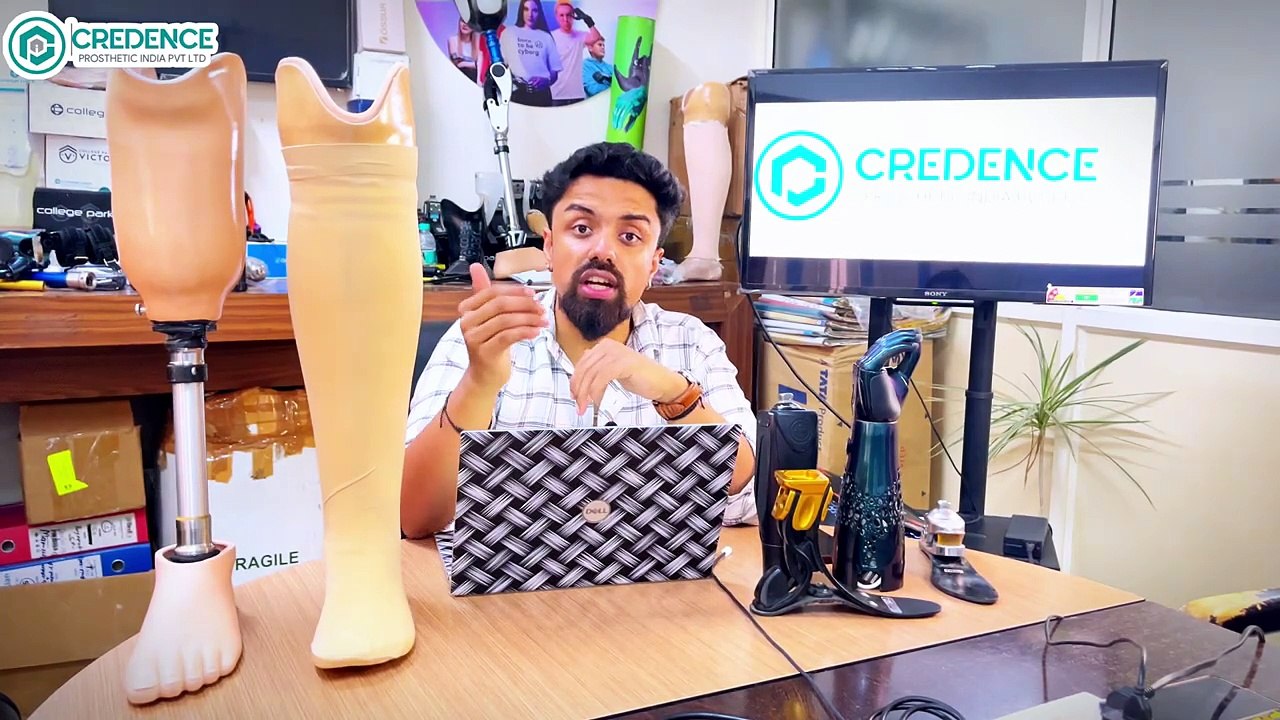 घुटने के नीचे का कृत्रिम पैर कैसा दिखता है | below knee Amputation leg india असली जैसा दिखने वाला