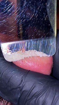 Skincare satisfying #1011