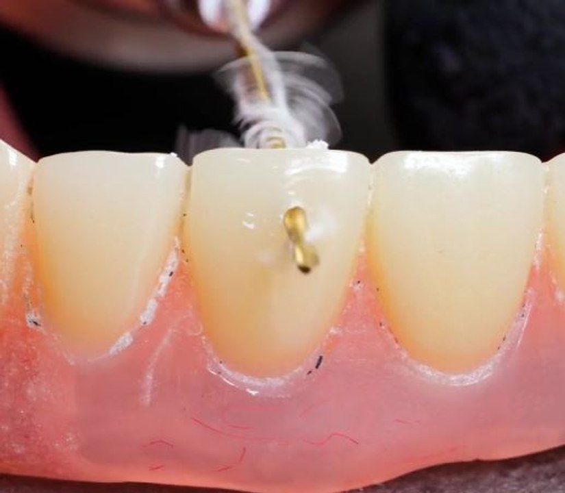 How to Make Your Teeth the Star