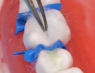 Dental Surgery, Doctor’s POV