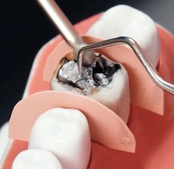 What Really Happens in the Dentist’s Chair