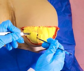 A Look Inside the Surgery Room! Explained Simply