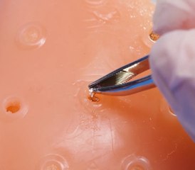 What to Expect During Surgery & Aesthetic Treatments