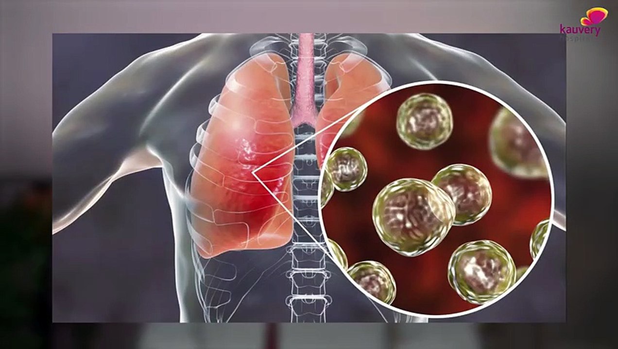 Should You Take the Pneumococcal Vaccine