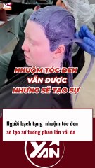 Người bạch tạng nhuộm tóc đen tạo sự tương phản lạ mắt