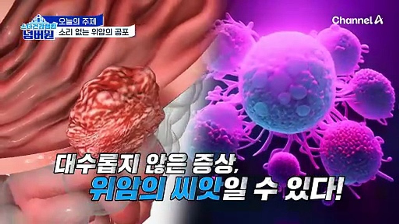 더운 여름철, 위 건강은 급격하게 나빠질 수 있다?! 소리 없는 위암의 공포