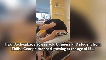 Student pays £36k to have his legs broken in surgery to become 3.7in taller