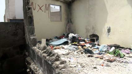 Un joven de 20 años prende fuego a su novia de 17 en un piso okupa en Gran Canaria