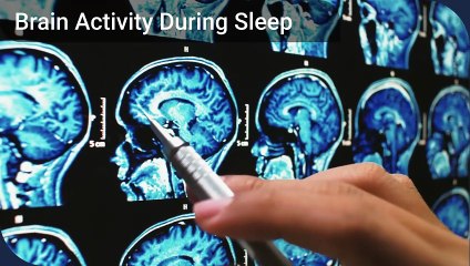 Why Do I Forget My Dreams When I Wake Up?