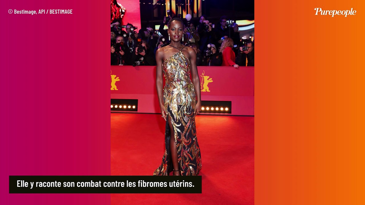 Cette actrice très réputée, touchée par une pathologie qui concerne 30 à 50% de femmes, brise le silence