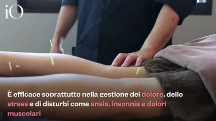 A cosa serve l'agopuntura? Tutti i benefici per corpo, mente e pelle perfetta