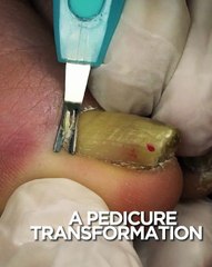 Amazing pedicure transformation!
