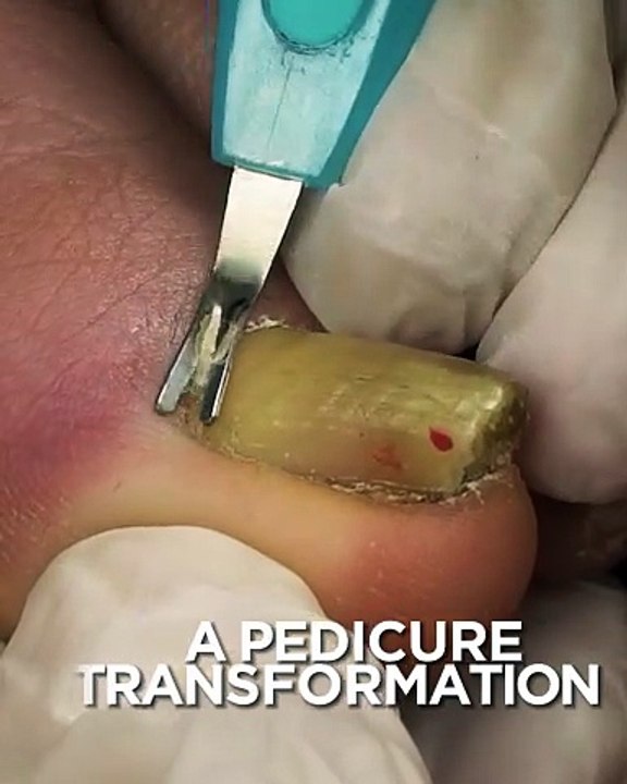 Amazing pedicure transformation!