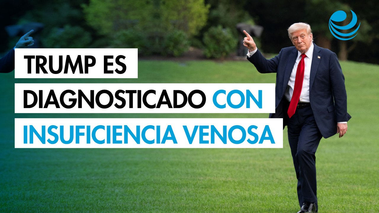 Donald Trump es diagnosticado con insuficiencia venosa crónica