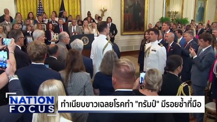 เฉลยโรค "ทรัมป์" มีรอยช้ำที่มือ | เนชั่นโฟกัส | 18 ก.ค. 68 | PART 3