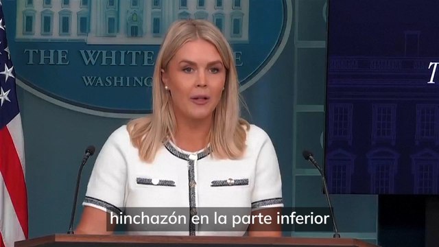 Trump padece insuficiencia venosa crónica