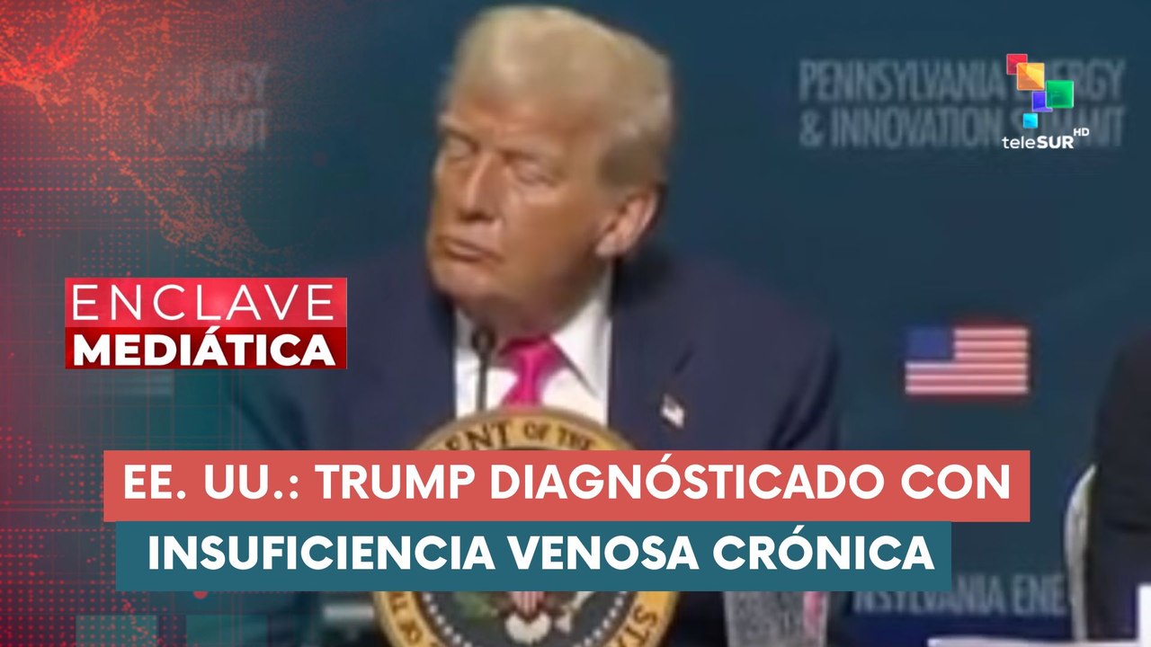 Trump diagnosticado con insuficiencia venosa crónica ENCLAVE MEDIÁTICA 17-07-2025