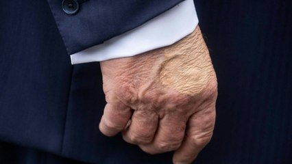 Trump-Sprecherin gibt Details zu dessen Venenleiden bekannt