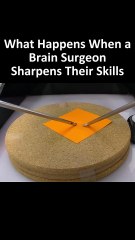 Brain surgery training... with a Post-it?! This surgeon's hack is ridiculous but brilliant