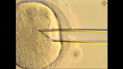 Nacen ocho bebés por donación mitocondrial: tienen el ADN de tres personas