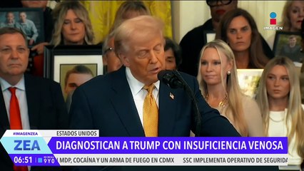 Donald Trump es diagnosticado con insuficiencia venosa crónica