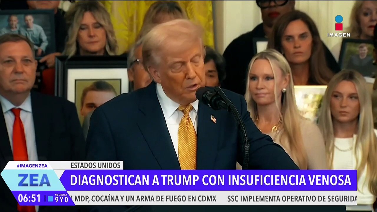 Donald Trump es diagnosticado con insuficiencia venosa crónica
