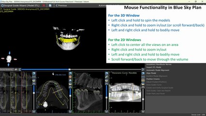 Designing Your First Surgical Guide in Blue Sky Plan Wizard - Version 4.13.31 Updated!