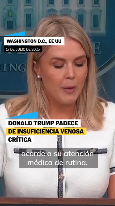 DONALD TRUMP padece insuficiencia venosa crónica